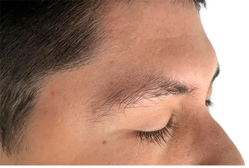 Antes