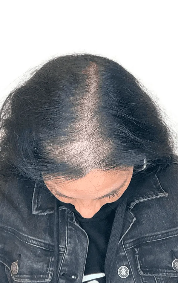Antes