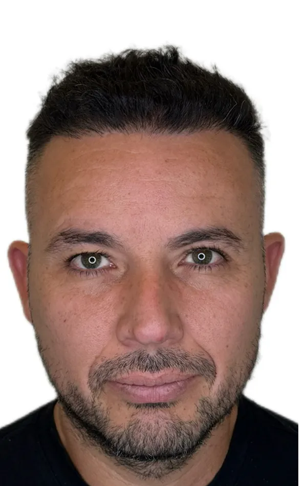 Después