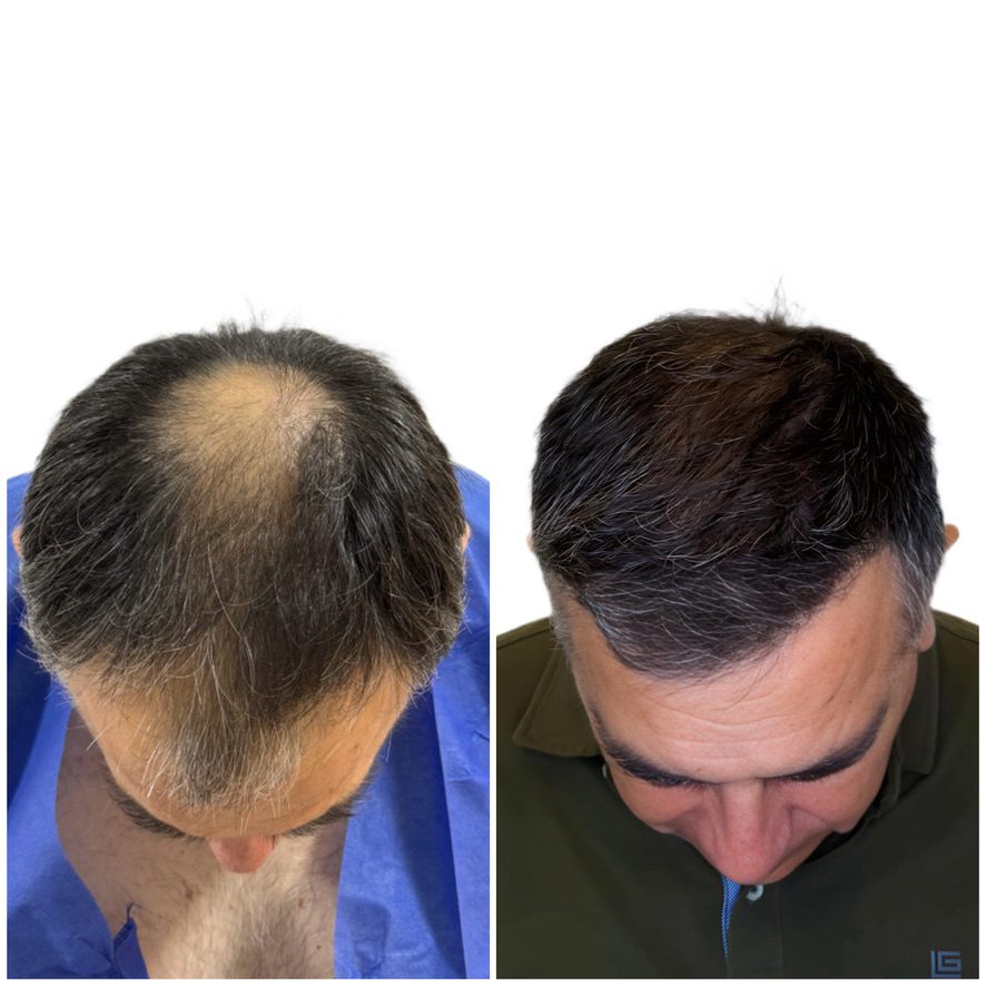 La experiencia de Carlos en Capilux